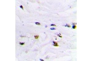 Immunohistochemical analysis of ZNF7 staining in human brain formalin fixed paraffin embedded tissue section. (ZNF7 Antikörper  (N-Term))