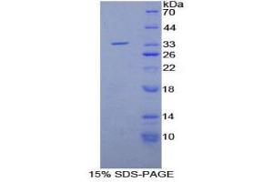 SDS-PAGE (SDS) image for Matrix Metallopeptidase 7 (Matrilysin, Uterine) (MMP7) (AA 1-267) protein (His tag) (ABIN2125829)