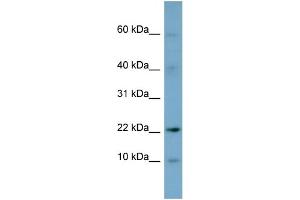 WB Suggested Anti-DPPA5 Antibody Titration: 0.