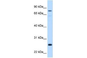 GSTM2 antibody used at 0.
