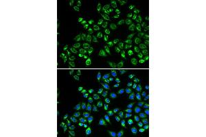 Immunofluorescence analysis of HeLa cells using C1QBP antibody (ABIN5970966). (C1QBP Antikörper)