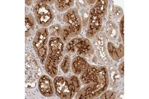 Immunohistochemical staining of human kidney with MICALL2 polyclonal antibody  shows strong cytoplasmic and membrane positivity in cells in tubules. (MICALL2 Antikörper)