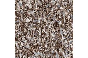 Immunohistochemical staining of human adrenal gland with SNIP polyclonal antibody  shows strong cytoplasmic positivity in cortical cells at 1:20-1:50 dilution. (SRCIN1 Antikörper)