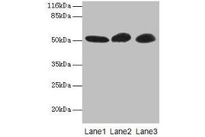 Western blot All lanes: GDI2 antibody at 2 μg/mL Lane 1: Mouse brain tissue Lane 2: HepG2 whole cell lysate Lane 3: MCF-7 whole cell lysate Secondary Goat polyclonal to rabbit IgG at 1/10000 dilution Predicted band size: 51, 46 kDa Observed band size: 51 kDa (GDI2 Antikörper  (AA 1-445))