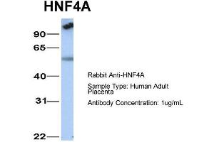 Host: Rabbit  Target Name: HNF4A  Sample Tissue: Human Adult Placenta  Antibody Dilution: 1.