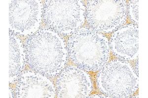 ABIN6260885 and ABIN6268761 at 1/100 staining Rat testis tissue by IHC-P. (Claudin 6 Antikörper  (Internal Region))