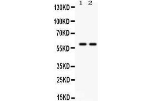 Anti- TH Picoband antibody, Western blotting All lanes: Anti TH  at 0. (TH Antikörper  (Middle Region))