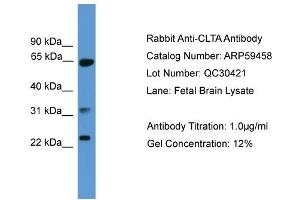 WB Suggested Anti-CLTA  Antibody Titration: 0. (CLTA Antikörper  (C-Term))