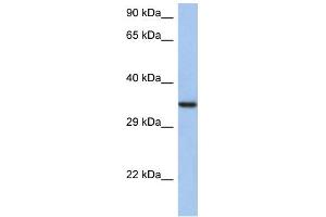 WB Suggested Anti-HORMAD2 Antibody Titration: 0. (HORMAD2 Antikörper  (N-Term))