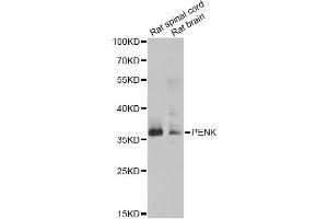 Western blot analysis of extracts of various cell lines, using PENK antibody.