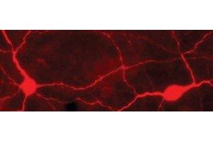 Immunostaining of light-stimulated rabbit retina showing labeling of TH when phosphorylated at Ser40. (Tyrosine Hydroxylase Antikörper  (pSer40))