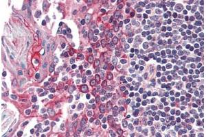 Human Tonsil (formalin-fixed, paraffin-embedded) stained with CSNK1E antibody ABIN337139 at 5 ug/ml followed by biotinylated anti-goat IgG secondary antibody ABIN481715, alkaline phosphatase-streptavidin and chromogen. (CK1 epsilon Antikörper  (AA 403-416))