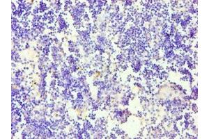 Immunohistochemistry of paraffin-embedded human thymus tissue using ABIN7158650 at dilution of 1:100 (CD58 Antikörper  (AA 40-220))