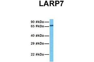 Host:  Rabbit  Target Name:  L Sample Tissue:  Human Hela  Antibody Dilution:  1. (LARP7 Antikörper  (C-Term))