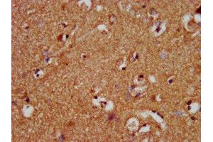 IHC image of ABIN7160821 diluted at 1:400 and staining in paraffin-embedded human brain tissue performed on a Leica BondTM system. (NLRP1 Antikörper  (AA 589-655))