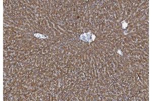 IHC analysis of MTTP using anti-MTTP antibody (ABIN7601145).