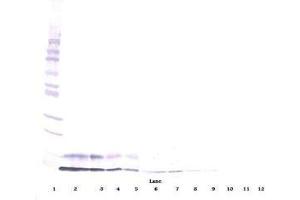 Image no. 1 for anti-Insulin-Like Growth Factor 1 (IGF1) antibody (ABIN464964) (IGF1 Antikörper)