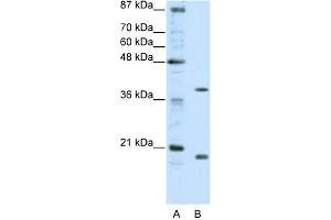 WB Suggested Anti-ZNF322A Antibody Titration:  0. (ZNF322A Antikörper  (C-Term))