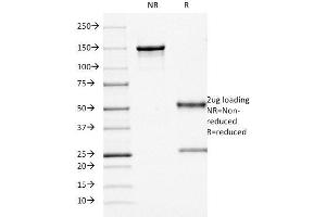 SDS-PAGE Analysis Purified CD68 Mouse Monoclonal Antibody (KP1). (CD68 Antikörper)