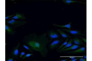 Immunofluorescence of purified MaxPab antibody to LY96 on HeLa cell. (LY96 Antikörper  (AA 19-160))