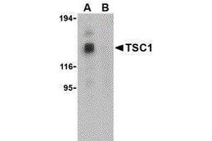Western Blotting (WB) image for anti-Tuberous Sclerosis 1 (TSC1) (Center) antibody (ABIN2476985) (TSC1 Antikörper  (Center))