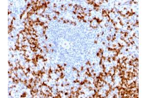 Immunohistochemistry (IHC) image for anti-Matrix Metallopeptidase 9 (Gelatinase B, 92kDa Gelatinase, 92kDa Type IV Collagenase) (MMP9) (AA 603-614) antibody (ABIN6940078)