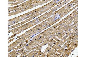 IHC analysis of ATP5F1B using anti-ATP5F1B antibody (ABIN7599866). (Atp5f1b (AA 123-529) Antikörper)
