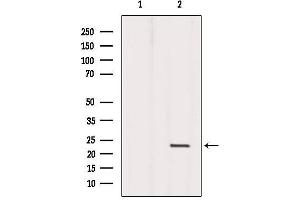 Western blot analysis of extracts from Mouse liver, using Dermatopontin Antibody. (Dermatopontin Antikörper  (Internal Region))