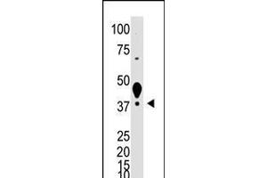 Antibody is used in Western blot to detect XLKD1 in mouse liver tissue lysate. (LYVE1 Antikörper  (N-Term))
