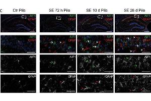 Immunostaining of mouse hippocampal CA1 region showing Aif1, green (microglia) and Gfap, red (astrocytes) staining 72 hrs, 10 days and 28 days after pilocarpine-induced status epilepticus (SE), SE (SE Pilo), compared to non-SE control animals (Ctr Pilo).
