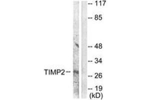 Western blot analysis of extracts from A549 cells, using TIMP2 Antibody. (TIMP2 Antikörper  (AA 21-70))