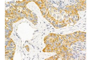 anti-B-Cell CLL/lymphoma 7B (BCL7B) (Internal Region) antibody