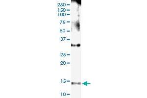 Immunoprecipitation of NPHP1 transfected lysate using anti-NPHP1 MaxPab rabbit polyclonal antibody and Protein A Magnetic Bead , and immunoblotted with NPHP1 MaxPab mouse polyclonal antibody (B01) . (NPHP1 Antikörper  (AA 1-121))