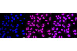 Immunocytochemical staining of HepG2 cells with CDC5 antibody (ABIN7797993), 1:1,000).