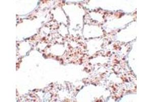 Immunohistochemistry (IHC) image for anti-Zinc Finger and SCAN Domain Containing 4 (ZSCAN4) (C-Term) antibody (ABIN1030831) (ZSCAN4 Antikörper  (C-Term))