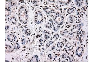 Immunohistochemical staining of paraffin-embedded breast tissue using anti-MAPK12 mouse monoclonal antibody. (MAPK12 Antikörper)