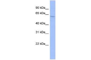 WB Suggested Anti-AIRE Antibody Titration:  0. (AIRE Antikörper  (Middle Region))