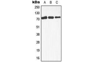 Western blot analysis of MEKK3 expression in Raji (A), A431 (B), HepG2 (C) whole cell lysates.