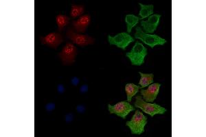Phospho-Fyn (Thr12) Antibody staining HepG2 cells(serum starvation treatment) by IF/ICC.