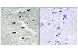 Immunohistochemistry (IHC) image for anti-Cell Division Cycle Associated 4 (CDCA4) (Internal Region) antibody (ABIN1850258) (CDCA4 Antikörper  (Internal Region))
