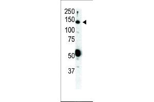 Western blot analysis of anti-Ret Pab (ABIN392038 and ABIN2841806) in SKBR3 cell lysate. (Ret Proto-Oncogene Antikörper  (N-Term))