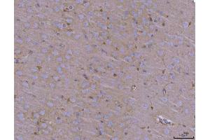 IHC analysis of ADAM22 using anti-ADAM22 antibody (ABIN7600714). (ADAM22 Antikörper  (AA 223-829))