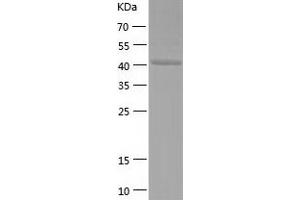 Western Blotting (WB) image for Synaptotagmin IV (SYT4) (AA 38-425) protein (His tag) (ABIN7288789) (SYT4 Protein (AA 38-425) (His tag))