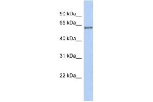 WB Suggested Anti-PCCB Antibody Titration: 0. (PCCB Antikörper  (Middle Region))
