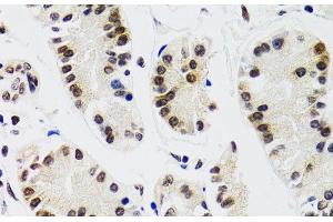 Immunohistochemistry (Paraffin-embedded Sections) (IHC (p)) image for anti-Endothelial Differentiation Related Factor 1 (EDF1) antibody (ABIN7260337)