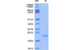 Human BPIFA1 on Tris-Bis PAGE under reduced condition. (BPIFA1 Protein (AA 20-256))