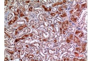 Immunohistochemistry (IHC) analysis of paraffin-embedded Human Kidney, antibody was diluted at 1:100.