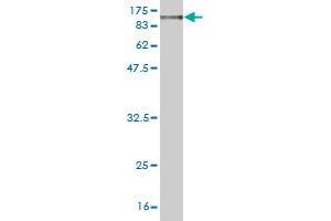 Western Blot detection against Immunogen (107. (MFN1 Antikörper  (AA 1-741))