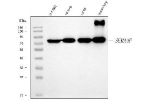 Western blot analysis of SEMA4F using anti-SEMA4F antibody (ABIN7601432).
