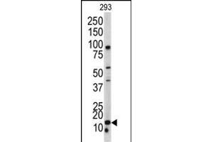 Western blot analysis of BLC antibody (N-term) (ABIN390537 and ABIN2840880) in 293 cell line lysates (35 μg/lane). (BAALC Antikörper  (N-Term))